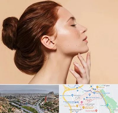 جراحی غبغب در معالی آباد شیراز