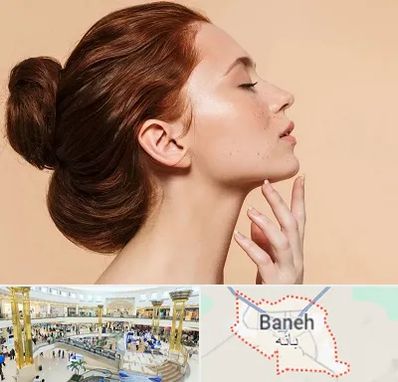 جراحی غبغب در بانه