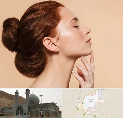 جراحی غبغب در شهرضا