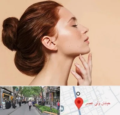 جراحی غبغب در ولیعصر شهریار