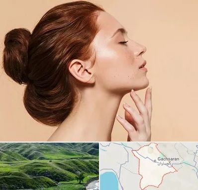 جراحی غبغب در گچساران