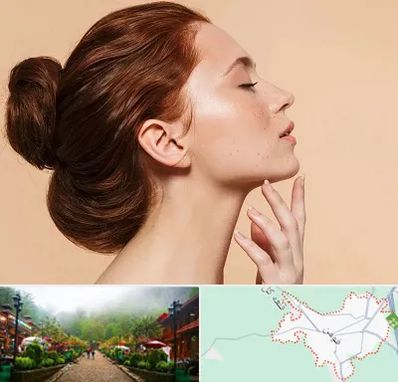 جراحی غبغب در فومن