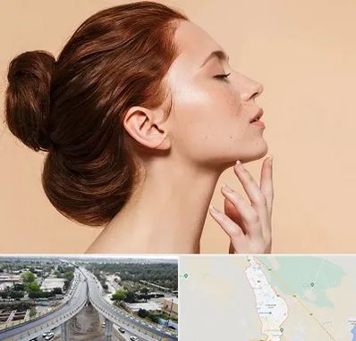 جراحی غبغب در اندیمشک