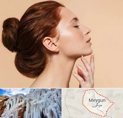 جراحی غبغب در میگون