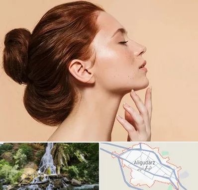 جراحی غبغب در الیگودرز