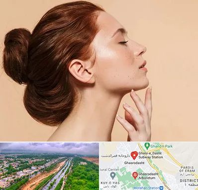 جراحی غبغب در قصرالدشت شیراز