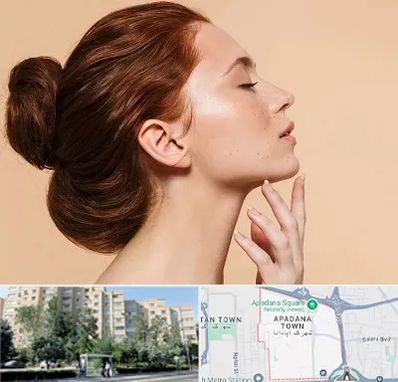 جراحی غبغب در آپادانا