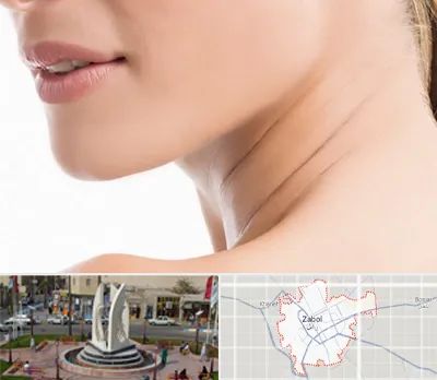 جراحی فک با لیزر در زابل