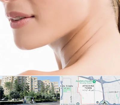 جراحی فک با لیزر در آپادانا