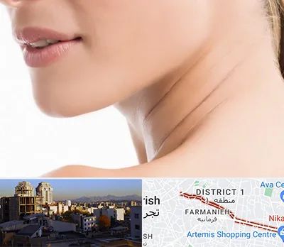 جراحی فک با لیزر در فرمانیه 