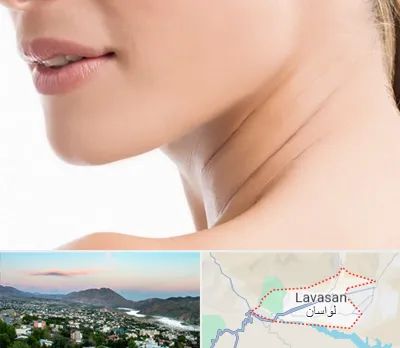 جراحی فک با لیزر در لواسان