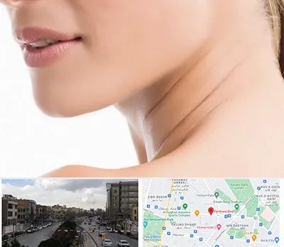 جراحی فک با لیزر در بلوار فردوسی مشهد