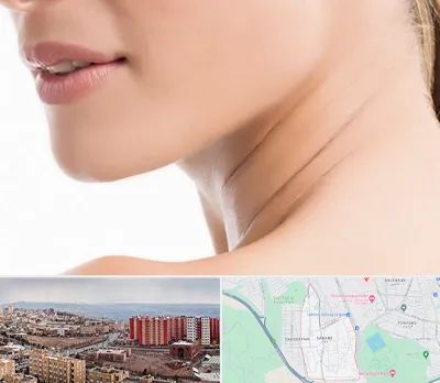 جراحی فک با لیزر در سهند تبریز