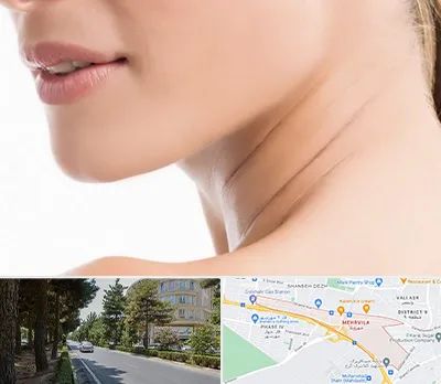 جراحی فک با لیزر در مهرویلا کرج