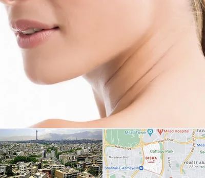 جراحی فک با لیزر در گیشا 