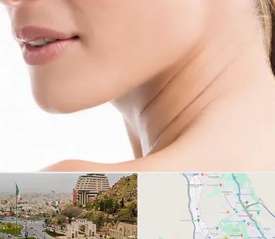 جراحی فک با لیزر در فرهنگ شهر شیراز