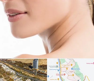 جراحی فک با لیزر در خیابان نیایش شیراز