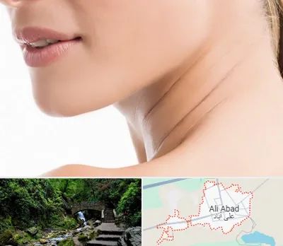 جراحی فک با لیزر در علی آباد کتول