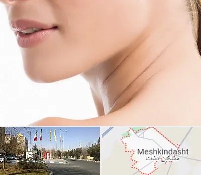 جراحی فک با لیزر در مشکین دشت