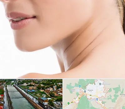 جراحی فک با لیزر در مراغه