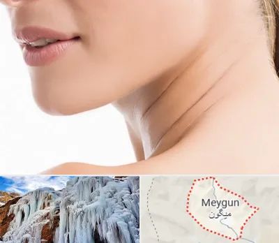 جراحی فک با لیزر در میگون