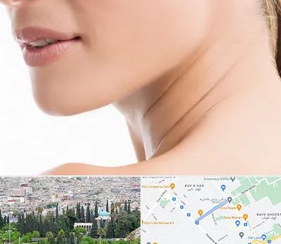 جراحی فک با لیزر در محلاتی شیراز