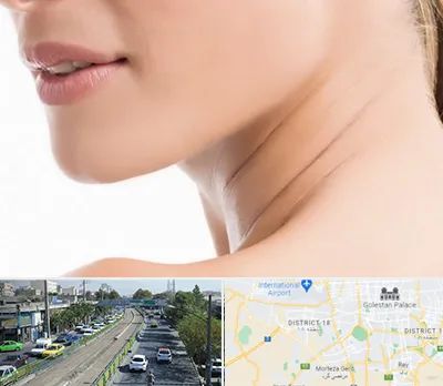 جراحی فک با لیزر در جنوب تهران 