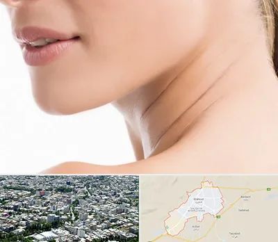 جراحی فک با لیزر در شاهرود
