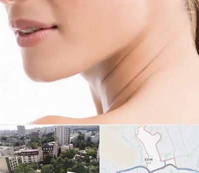 جراحی فک با لیزر در اوین