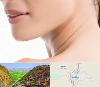 جراحی فک با لیزر در کامیاران