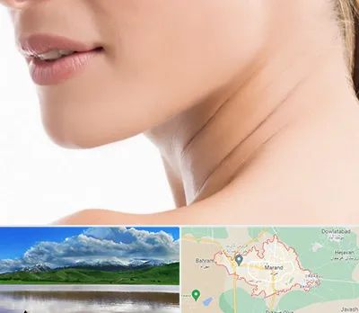 جراحی فک با لیزر در مرند