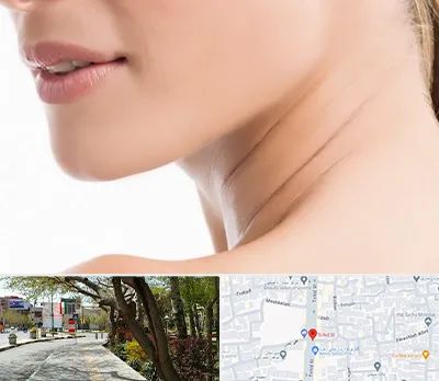 جراحی فک با لیزر در خیابان توحید اصفهان