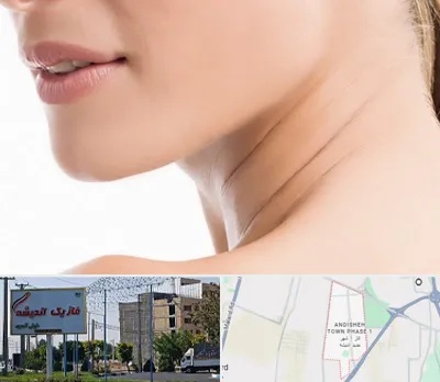 جراحی فک با لیزر در فاز یک اندیشه
