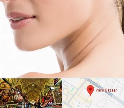 جراحی فک با لیزر در بازار وکیل شیراز