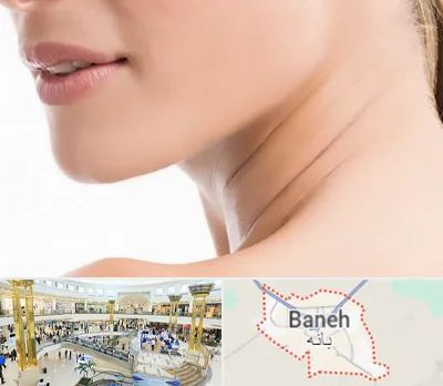 جراحی فک با لیزر در بانه
