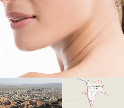 جراحی فک با لیزر در اسفراین
