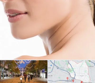 جراحی فک با لیزر در ولیعصر ارومیه