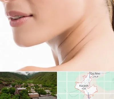 جراحی فک با لیزر در کلاله