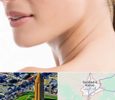 جراحی فک با لیزر در گنبد کاووس