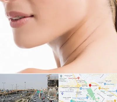 جراحی فک با لیزر در بلوار توس مشهد