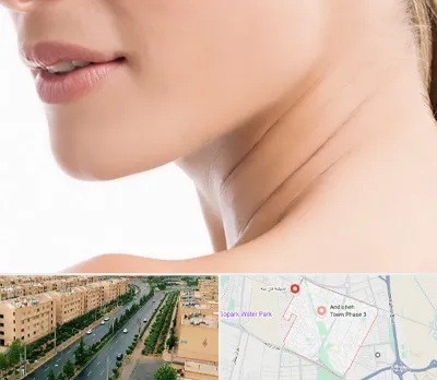 جراحی فک با لیزر در فاز سه اندیشه