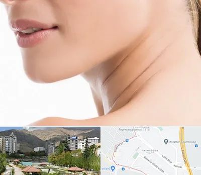 جراحی فک با لیزر در شهر زیبا 