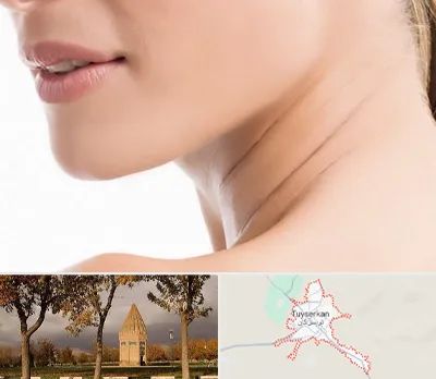 جراحی فک با لیزر در تویسرکان