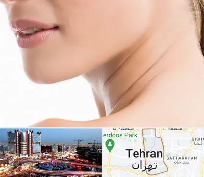 جراحی فک با لیزر در صادقیه 