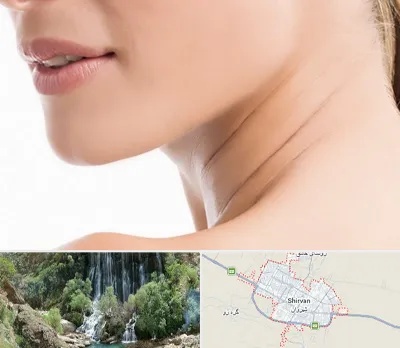 جراحی فک با لیزر در شیروان