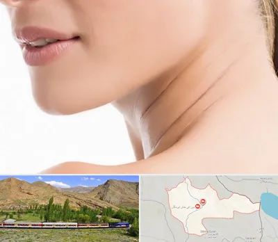 جراحی فک با لیزر در خاش