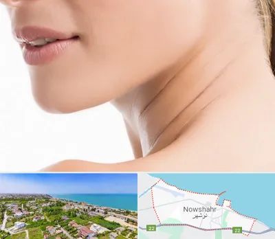 جراحی فک با لیزر در نوشهر