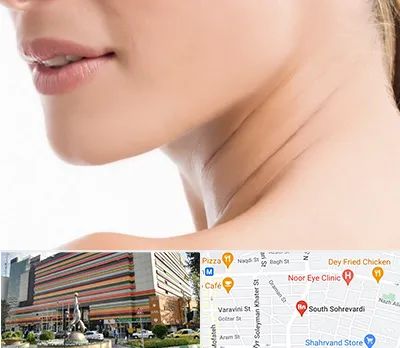 جراحی فک با لیزر در سهروردی 