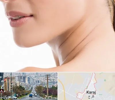 جراحی فک با لیزر در گوهردشت کرج 