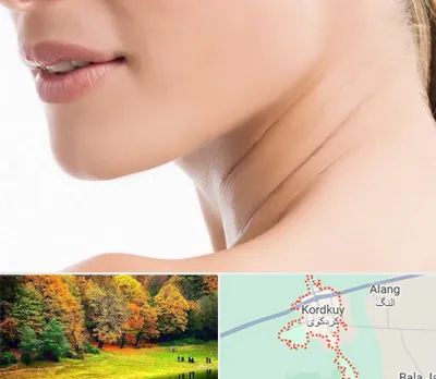 جراحی فک با لیزر در کردکوی